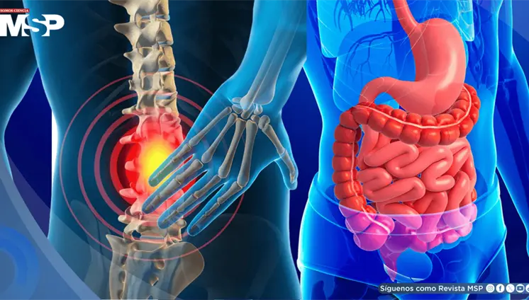 ¿Dolor de espalda constante? trastornos digestivos estarían relacionados con el dolor lumbar
