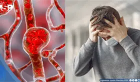 Estrés crónico eleva el azúcar en sangre y aumenta el riesgo de diabetes tipo 2: Estudio