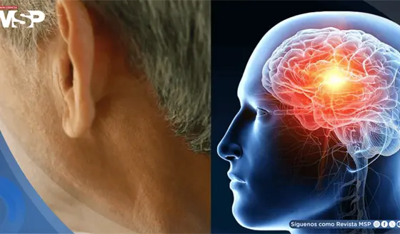 Pérdida auditiva en la mediana edad aumentaría el 71% el riesgo de demencia, según estudio