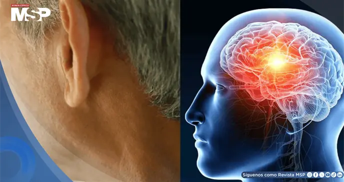 Pérdida auditiva en la mediana edad aumentaría el 71% el riesgo de demencia, según estudio