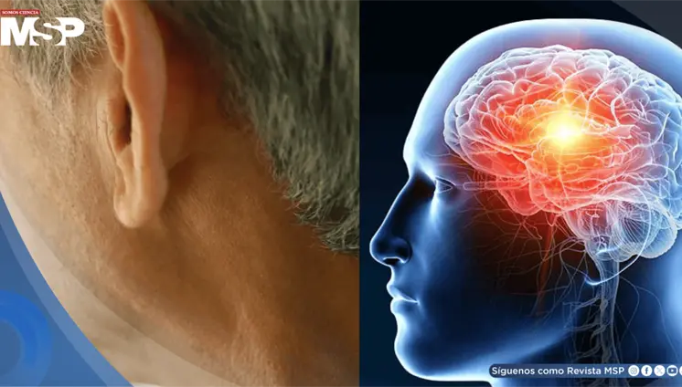 Pérdida auditiva en la mediana edad aumentaría el 71% el riesgo de demencia, según estudio