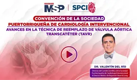 Avances en la técnica de reemplazo de válvula aórtica transcatéter (TAVR)