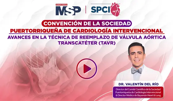 Avances en la técnica de reemplazo de válvula aórtica transcatéter (TAVR)