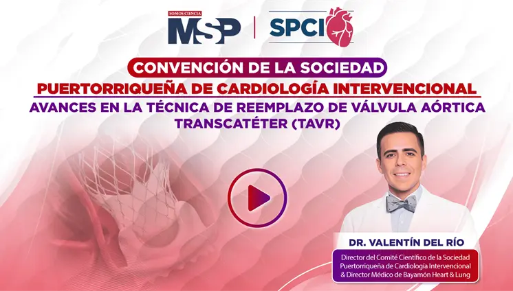 Avances en la técnica de reemplazo de válvula aórtica transcatéter (TAVR)