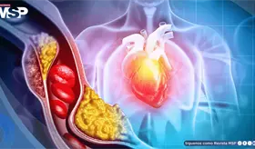 Diabetes podría multiplicar hasta siete veces el riesgo de muerte súbita cardíaca en jóvenes