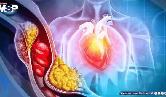 Diabetes podría multiplicar hasta siete veces el riesgo de muerte súbita cardíaca en jóvenes
