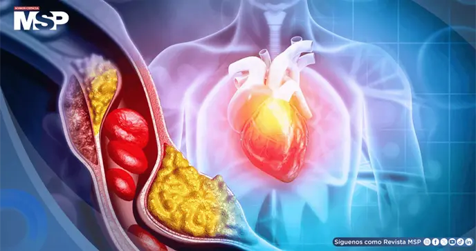 Diabetes podría multiplicar hasta siete veces el riesgo de muerte súbita cardíaca en jóvenes
