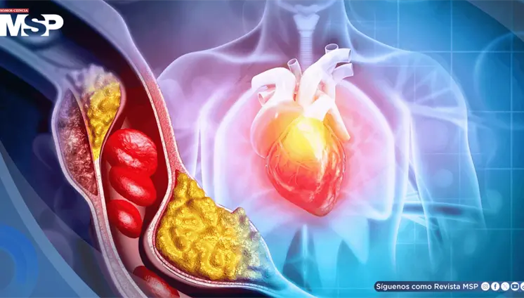 Diabetes podría multiplicar hasta siete veces el riesgo de muerte súbita cardíaca en jóvenes