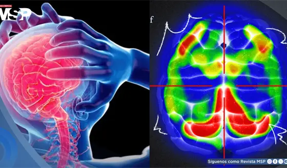 ¿Cómo reconocer un ataque de pánico? Qué pasa en el cuerpo, síntomas y cómo recuperar el control