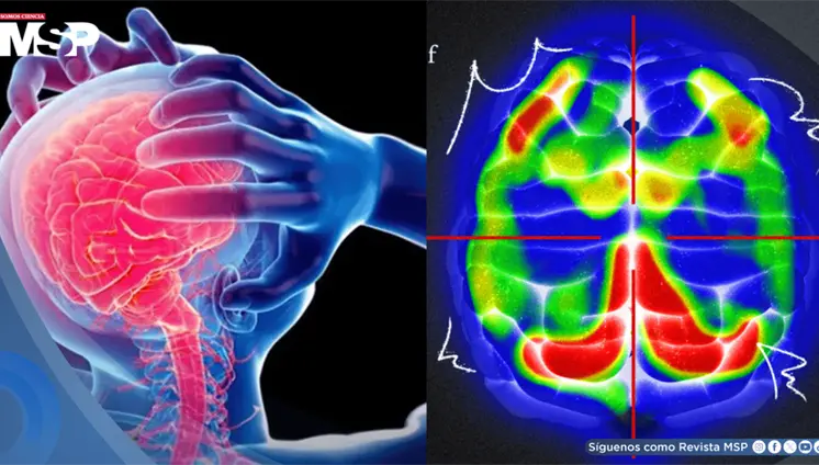 ¿Cómo reconocer un ataque de pánico? Qué pasa en el cuerpo, síntomas y cómo recuperar el control
