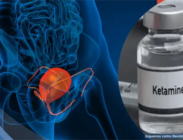 Adicción a la ketamina obliga a jóvenes de 19 años a someterse a cirugías de vejiga