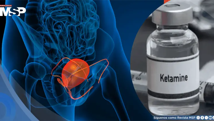 Adicción a la ketamina obliga a jóvenes de 19 años a someterse a cirugías de vejiga Adicción a la ketamina obliga a jóvenes de 19 años a someterse a cirugías de vejiga