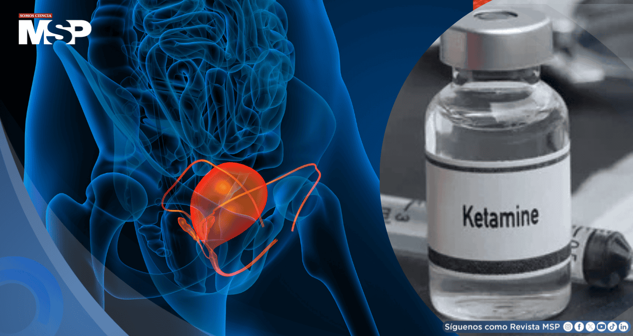 Adicción a la ketamina obliga a jóvenes de 19 años a someterse a cirugías de vejiga