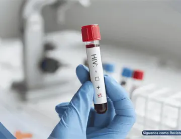 Crean prueba que diferencia infección real de VIH de falsos positivos causados por vacunas experimentales