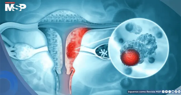 Fármaco para el asma complementaría el tratamiento de cáncer de ovario al superar barreras inmunitarias