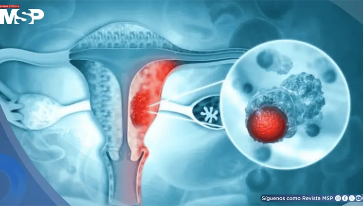 Fármaco para el asma complementaría el tratamiento de cáncer de ovario al superar barreras inmunitarias Fármaco para el asma complementaría el tratamiento de cáncer de ovario al superar barreras inmunitarias