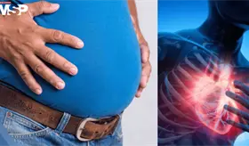 La panza de cerveza es más peligrosa para el corazón que el sobrepeso general, según estudio