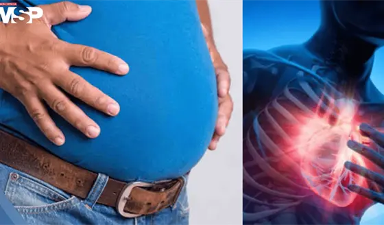 La panza de cerveza es más peligrosa para el corazón que el sobrepeso general, según estudio