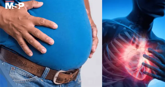 La panza de cerveza es m&aacute;s peligrosa para el coraz&oacute;n que el sobrepeso general, seg&uacute;n estudio