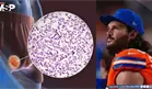 Un test antidopaje le salvó la vida: Linebacker de la NFL detecta cáncer testicular por accidente 
