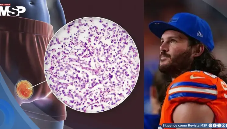 Un test antidopaje le salvó la vida: Linebacker de la NFL detecta cáncer testicular por accidente Un test antidopaje le salvó la vida: Linebacker de la NFL detecta cáncer testicular por accidente