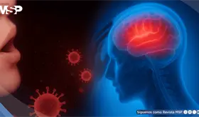 La gripe podría desencadenar infartos e ictus en las semanas posteriores a la infección, según estudio