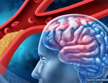 Ocho bebidas energéticas al día desencadenarían un derrame cerebral: “cafeína oculta”