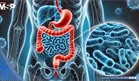 Aditivos en ultraprocesados podrían debilitar la barrera intestinal  e incrementar la inflamación