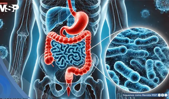 Aditivos en ultraprocesados podrían debilitar la barrera intestinal  e incrementar la inflamación