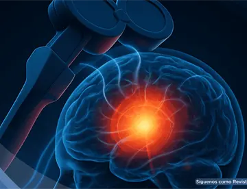 Estimulación magnética transcraneal frenaría el deterioro cognitivo y la demencia en 76% de los pacientes