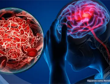 Los cinco síntomas más comunes de un ACV y por qué no debes esperar para ir al hospital, según neurólogo