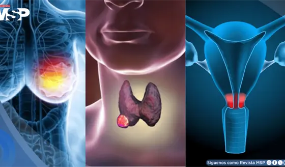 Las razones detrás del aumento del cáncer en mujeres menores de 50 años: Expertos