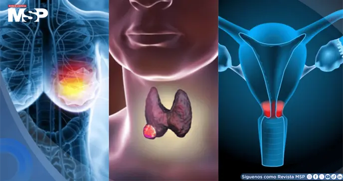 Las razones detrás del aumento del cáncer en mujeres menores de 50 años: Expertos Las razones detrás del aumento del cáncer en mujeres menores de 50 años: Expertos