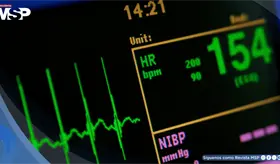 Convierten señales Wi-Fi en monitores cardíacos que detectan anomalías en latidos y respiración