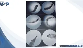 Diagnóstico tardío de miasis urogenital provoca necrosis y compromiso vesicouretral