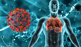 Mini-examen cl&iacute;nico: Virus sincitial respiratorio