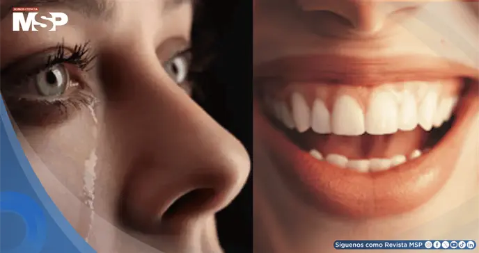 S&iacute;ndrome pseudobulbar: As&iacute; es la enfermedad que provoca episodios incontrolables de risa y llanto