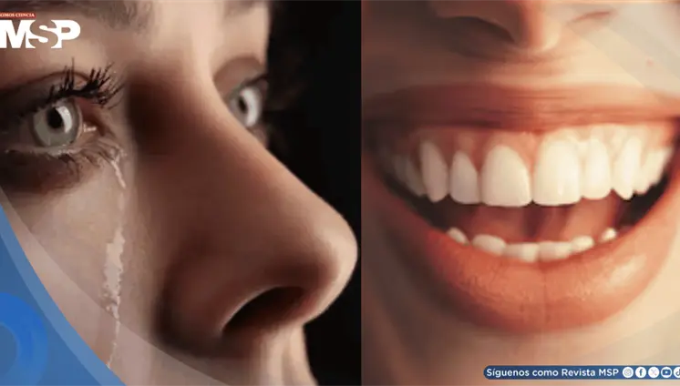 Síndrome pseudobulbar: Así es la enfermedad que provoca episodios incontrolables de risa y llanto Síndrome pseudobulbar: Así es la enfermedad que provoca episodios incontrolables de risa y llanto