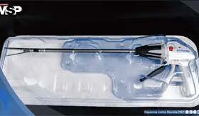 Desarrollan primera endograpadora con angulaci&oacute;n de 90 grados para cirug&iacute;a pulmonar