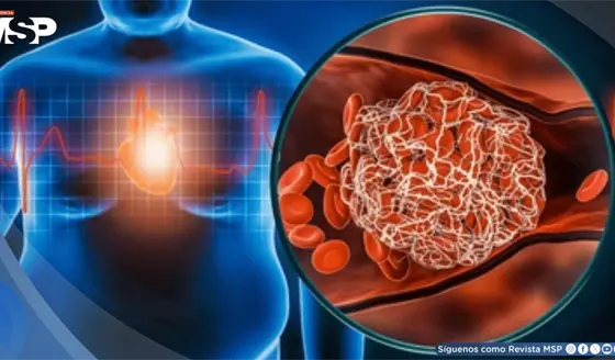 Dejar Ozempic y otros f&aacute;rmacos para la obesidad provocar&iacute;a rebote de peso y deterioro card&iacute;aco 