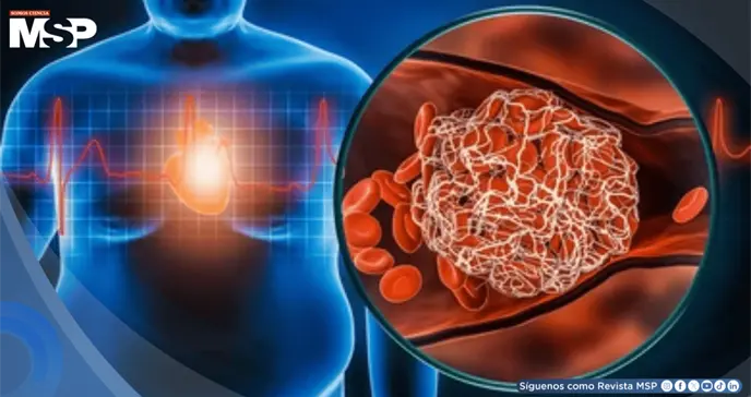 Dejar Ozempic y otros f&aacute;rmacos para la obesidad provocar&iacute;a rebote de peso y deterioro card&iacute;aco 