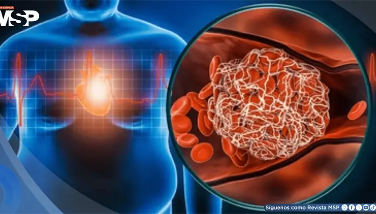 Dejar Ozempic y otros fármacos para la obesidad provocaría rebote de peso y deterioro cardíaco Dejar Ozempic y otros fármacos para la obesidad provocaría rebote de peso y deterioro cardíaco