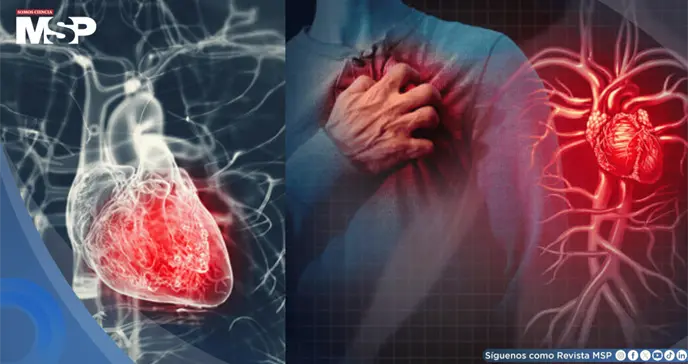Opresi&oacute;n en el pecho, sudor fr&iacute;o, n&aacute;useas y falta de aire:&iquest;es pericarditis o infarto? Lo que debes saber