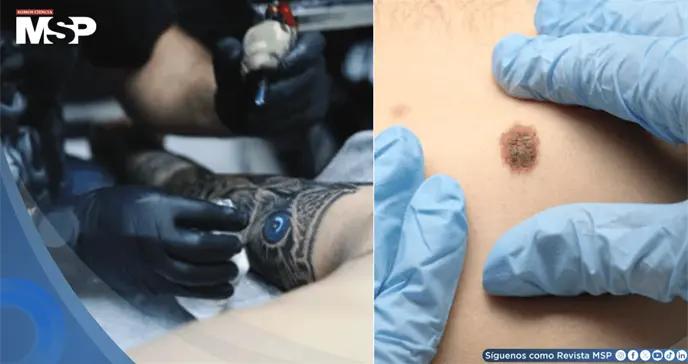 Tatuajes y piercings dificultar&iacute;an detecci&oacute;n temprana de lesiones malignas en la piel, advierten m&eacute;dicos