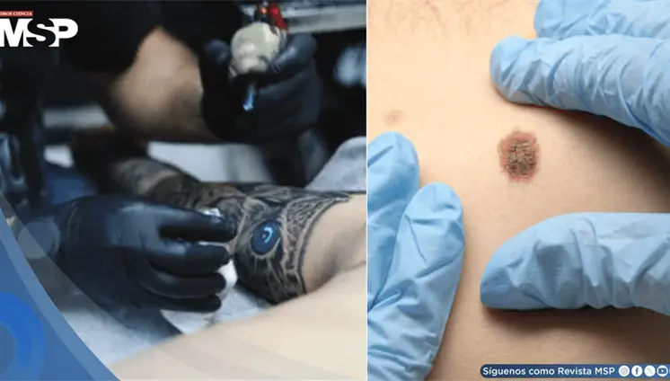 Tatuajes y piercings dificultarían detección temprana de lesiones malignas en la piel, advierten médicos Tatuajes y piercings dificultarían detección temprana de lesiones malignas en la piel, advierten médicos