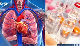 Acn&eacute;, Hipertensi&oacute;n y ataque al coraz&oacute;n: Estos podr&iacute;an ser los riesgos de consumir esteroides anab&oacute;licos