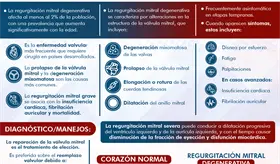 Regurgitaci&oacute;n Mitral Degenerativa