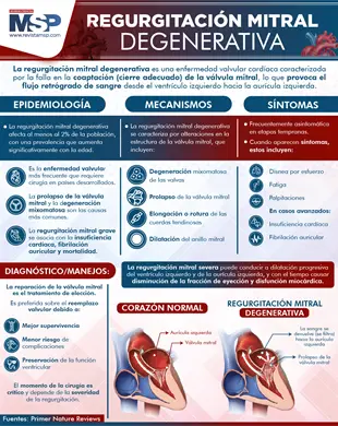 Regurgitaci&oacute;n Mitral Degenerativa