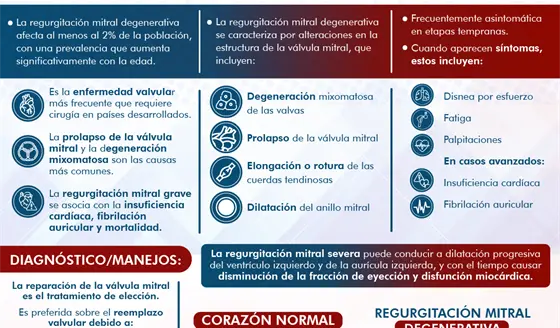Regurgitaci&oacute;n Mitral Degenerativa