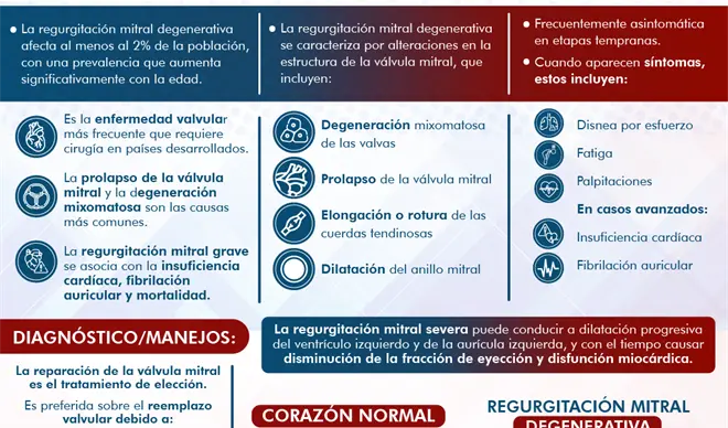 Regurgitaci&oacute;n Mitral Degenerativa